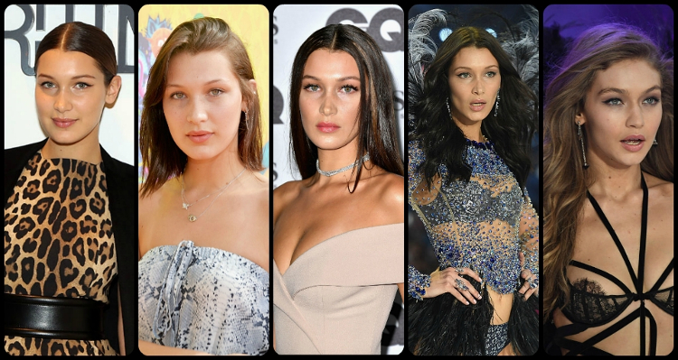 Check Out Bella Hadid Before and After Surgery Photos
